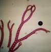 epifytická až epipelická červená riasa s klieštikovito zahnutými vetvičkami(stielka)<br>patrí do Plantae-Rhodophyta-Florideophyceae