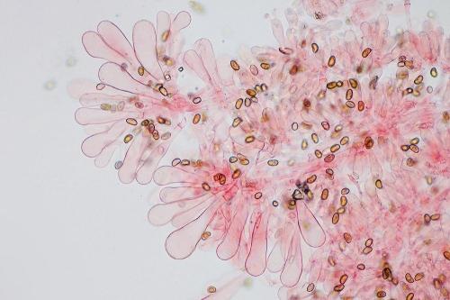 vláknica škvrnitá / vláknice skvrnitá