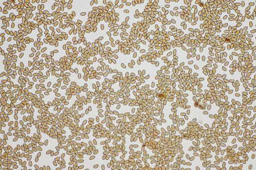 vláknica škvrnitá / vláknice skvrnitá