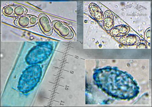 čiaška miskovitá / řasnatka síromléčná