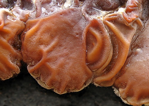 uchovka pásikavá / boltcovitka mozkovitá