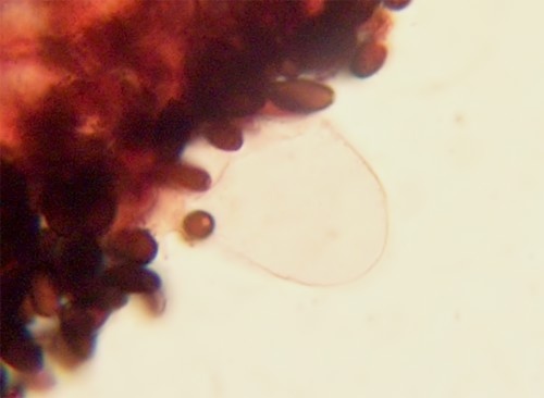 Hnojník Krieglsteinerov