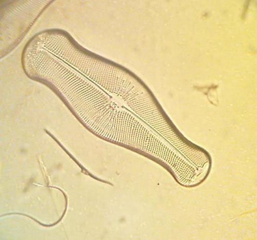 Didymosphenia geminata